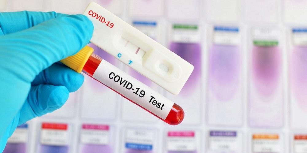 Rapid Test di Pasar, Delapan Pedagang di Lubuklinggau Reaktif Covid-19
